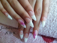 Francia hegyes